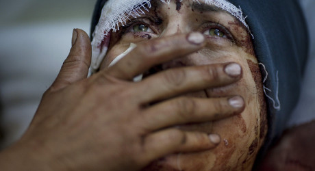 10 фотоисторий о силе человеческой воли