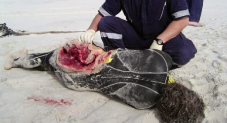 Нападения акул: в каких странах они нападают чаще